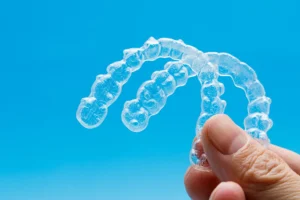 Invisalign dla dzieci